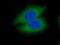 Casein Kinase 2 Beta antibody, 22418-1-AP, Proteintech Group, Immunofluorescence image 