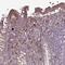 NHS Like 2 antibody, NBP2-30932, Novus Biologicals, Immunohistochemistry paraffin image 