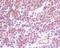C-C Motif Chemokine Receptor 7 antibody, M00390, Boster Biological Technology, Immunohistochemistry paraffin image 