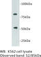 Protein C, Inactivator Of Coagulation Factors Va And VIIIa antibody, MBS355196, MyBioSource, Western Blot image 