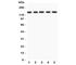 Integrin Subunit Alpha 6 antibody, R31334, NSJ Bioreagents, Western Blot image 