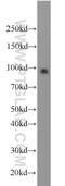 Ring Finger Protein 10 antibody, 16936-1-AP, Proteintech Group, Western Blot image 