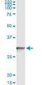 Glutathione S-Transferase Theta 2 (Gene/Pseudogene) antibody, LS-C197372, Lifespan Biosciences, Immunoprecipitation image 