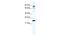 Zinc Finger Protein 287 antibody, 28-675, ProSci, Enzyme Linked Immunosorbent Assay image 