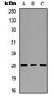 Troponin I3, Cardiac Type antibody, LS-C358371, Lifespan Biosciences, Western Blot image 