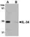 Interleukin 34 antibody, LS-C83915, Lifespan Biosciences, Western Blot image 