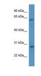 Cytokine Inducible SH2 Containing Protein antibody, NBP1-79513, Novus Biologicals, Western Blot image 