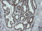 Carboxypeptidase A2 antibody, LS-C173918, Lifespan Biosciences, Immunohistochemistry paraffin image 