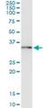 Ubiquitin Conjugating Enzyme E2 R2 antibody, H00054926-M01, Novus Biologicals, Immunoprecipitation image 