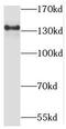 Matrilin 2 antibody, FNab05031, FineTest, Western Blot image 