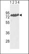 Endothelin Converting Enzyme 1 antibody, PA5-72480, Invitrogen Antibodies, Western Blot image 