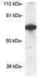 Cytoplasmic Polyadenylation Element Binding Protein 1 antibody, GTX23465, GeneTex, Western Blot image 