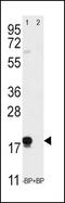 Thy-1 Cell Surface Antigen antibody, PA5-11917, Invitrogen Antibodies, Western Blot image 
