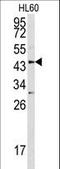 Asporin antibody, LS-C99335, Lifespan Biosciences, Western Blot image 