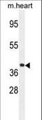 G Protein Subunit Alpha 15 antibody, LS-C166544, Lifespan Biosciences, Western Blot image 