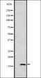 Heat Shock Protein Family B (Small) Member 9 antibody, orb335317, Biorbyt, Western Blot image 