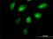 SET Domain Bifurcated Histone Lysine Methyltransferase 1 antibody, H00009869-M07, Novus Biologicals, Immunocytochemistry image 