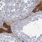Lipin 1 antibody, HPA038021, Atlas Antibodies, Immunohistochemistry frozen image 