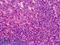 Thymidine Kinase 1 antibody, LS-B1841, Lifespan Biosciences, Immunohistochemistry frozen image 