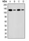 Activity Dependent Neuroprotector Homeobox antibody, orb382525, Biorbyt, Western Blot image 