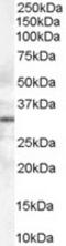 Syntaxin-6 antibody, TA302620, Origene, Western Blot image 