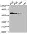 Pyruvate dehydrogenase [ubiquinone] antibody, A52125-100, Epigentek, Western Blot image 