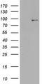 Phospholipase A2 Group VI antibody, NBP2-46431, Novus Biologicals, Western Blot image 