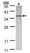 Ornithine Carbamoyltransferase antibody, NBP1-31582, Novus Biologicals, Western Blot image 