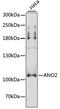 Anoctamin 2 antibody, LS-C748168, Lifespan Biosciences, Western Blot image 