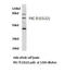 Protein Kinase C Theta antibody, LS-C177429, Lifespan Biosciences, Western Blot image 