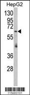 Arginyl-TRNA Synthetase 2, Mitochondrial antibody, MBS9210057, MyBioSource, Western Blot image 