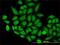 Translocase Of Outer Mitochondrial Membrane 22 antibody, H00056993-M01, Novus Biologicals, Immunofluorescence image 