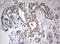 Flap Structure-Specific Endonuclease 1 antibody, LS-C789619, Lifespan Biosciences, Immunohistochemistry paraffin image 