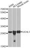 Ubiquitin C-Terminal Hydrolase L1 antibody, A0148, ABclonal Technology, Western Blot image 
