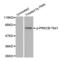 Protein Kinase C Beta antibody, abx000243, Abbexa, Western Blot image 