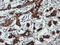 Gamma-Butyrobetaine Hydroxylase 1 antibody, LS-C174520, Lifespan Biosciences, Immunohistochemistry paraffin image 