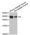 Coagulation Factor VIII antibody, MBS126910, MyBioSource, Western Blot image 