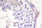 Lipase E, Hormone Sensitive Type antibody, LS-C177164, Lifespan Biosciences, Immunohistochemistry paraffin image 