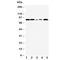 Fibroblast Growth Factor Receptor 1 antibody, R30549, NSJ Bioreagents, Western Blot image 