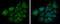 Enoyl-CoA hydratase, mitochondrial antibody, GTX114376, GeneTex, Immunofluorescence image 