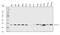 NADH:Ubiquinone Oxidoreductase Subunit B8 antibody, A07936-1, Boster Biological Technology, Western Blot image 