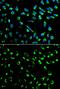 Stratifin antibody, GTX32418, GeneTex, Immunofluorescence image 