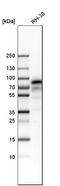 Nerve Growth Factor Receptor antibody, HPA004765, Atlas Antibodies, Western Blot image 