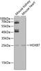 Homeobox protein Hox-B7 antibody, 22-559, ProSci, Western Blot image 