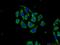 Tetratricopeptide Repeat Domain 31 antibody, 21693-1-AP, Proteintech Group, Immunofluorescence image 