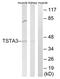 Tissue Specific Transplantation Antigen P35B antibody, AP33267PU-N, Origene, Western Blot image 