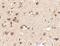 Serine/Threonine Kinase 39 antibody, NBP1-76957, Novus Biologicals, Immunohistochemistry paraffin image 