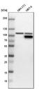 Phosphoribosylglycinamide Formyltransferase, Phosphoribosylglycinamide Synthetase, Phosphoribosylaminoimidazole Synthetase antibody, NBP1-87290, Novus Biologicals, Western Blot image 