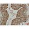 p53 antibody, LS-C387837, Lifespan Biosciences, Immunohistochemistry paraffin image 
