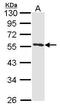 Annexin A11 antibody, GTX114256, GeneTex, Western Blot image 